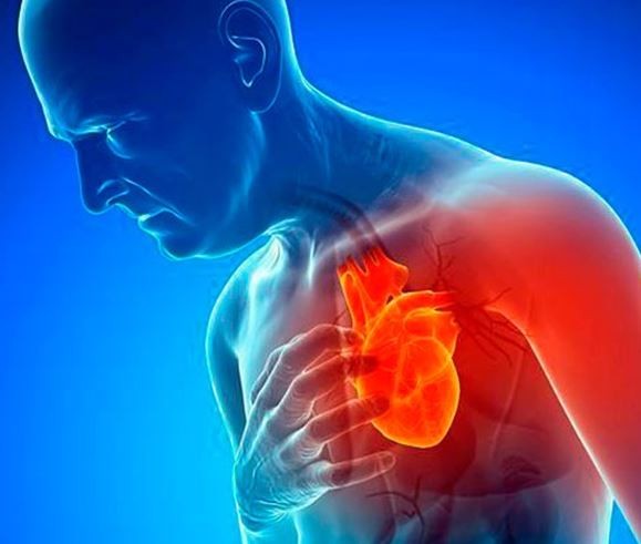 Los síntomas previos a un ataque cardíaco en hombres y mujeres