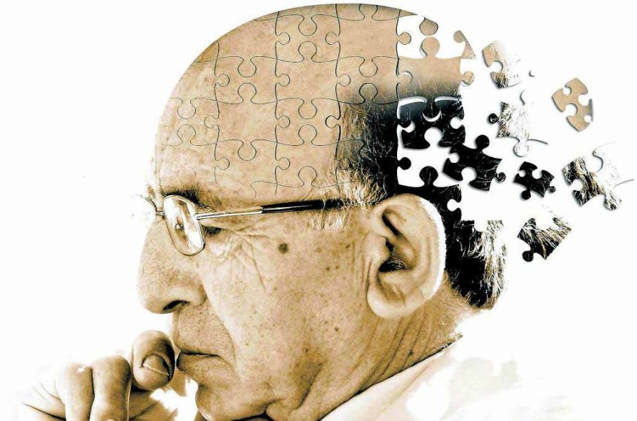 Alzheimer: por qué puede ser detectado 20 años antes de la aparición de síntomas
